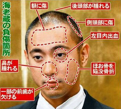 Ichikawa Ebizo